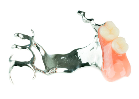 Clínica Dental Doctores Viloria Prótesis parcial de cromo