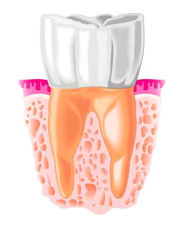 Clínica Dental Doctores Viloria periodoncia 2