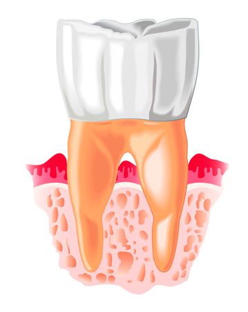 Clínica Dental Doctores Viloria periodoncia 1